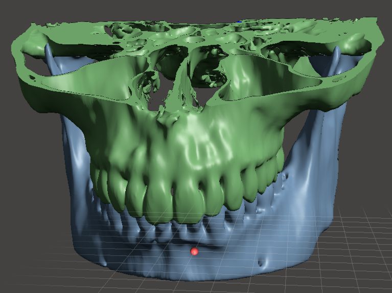 Render — Mandíbula y maxilar